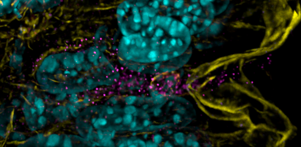 Intestinal M cell